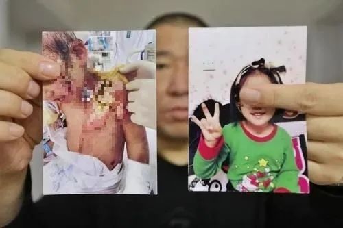 令人发指！滚水浇头、铁钳拔牙…6岁女童遭生母及男友虐待！
